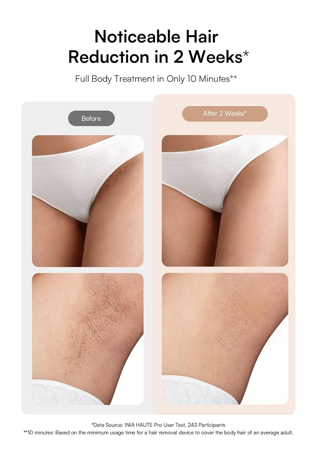 Laser Hair Removal with Ice-Cooling Care for Women and Men, Painless At-Home IPL Hair Remover for Coarse Hair in Bikini and All Body Areas, Latest Generation for Effective &amp; Long-Lasting Results